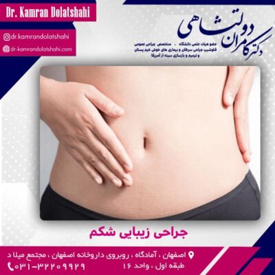 جراحی زیبایی شکم - دکتر دولتشاهی