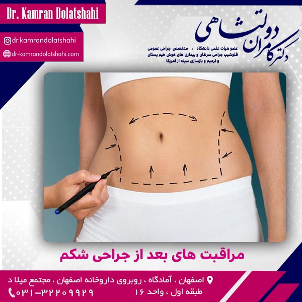 مراقبت های بعد از جراحی شکم