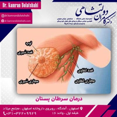درمان سرطان پستان در اصفهان - دکتر دولتشاهی