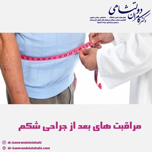 مراقبت های بعد از جراحی شکم - دکتر دولتشاهی