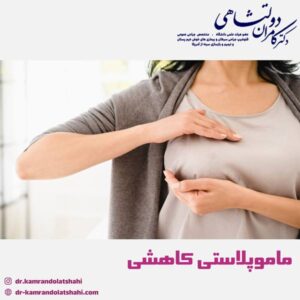 ماموپلاستی کاهشی - دکتر دولتشاهی