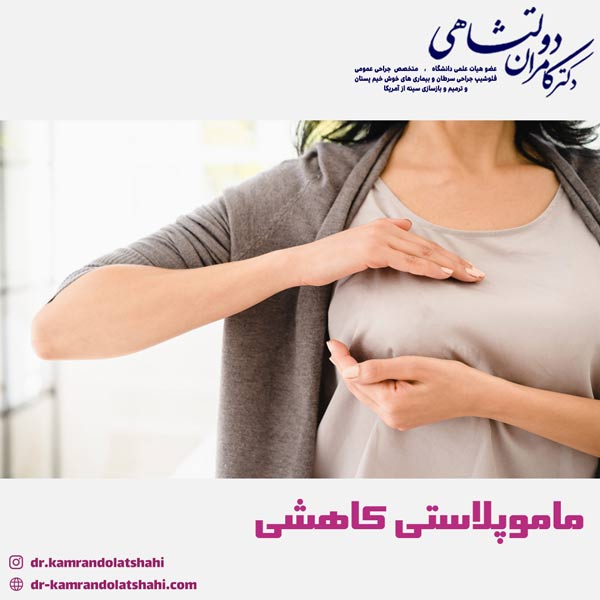 ماموپلاستی کاهشی - دکتر دولتشاهی