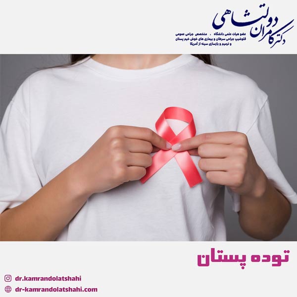 توده پستان - دکتر دولتشاهی