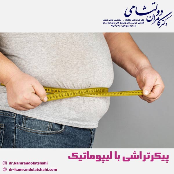 لیپوماتیک - دکتر دولتشاهی