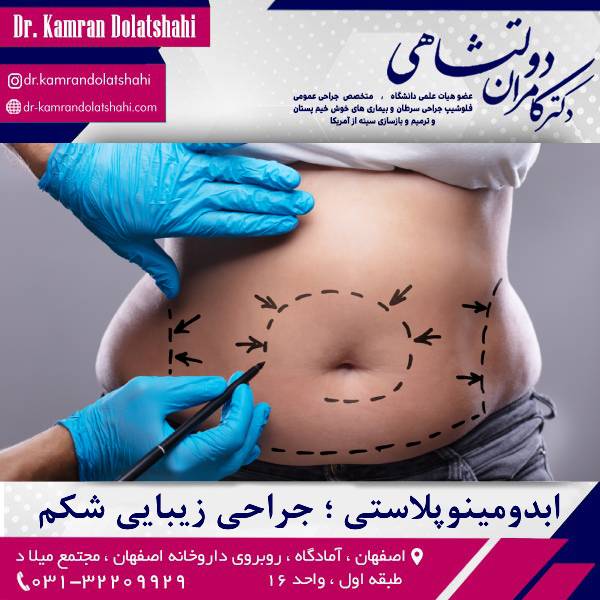 جراحی زیبایی شکم 