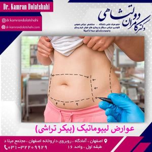 عوارض لیپوماتیک - دکتر کامران دولت شاهی