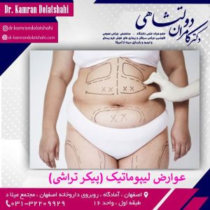 عوارض لیپوماتیک (پیکرتراشی) - دکتر دولتشاهی