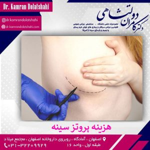 هزینه پروتز سینه - دکتر کامران دولتشاهی