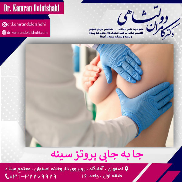 علل و علائم جا به جایی پروتز سینه