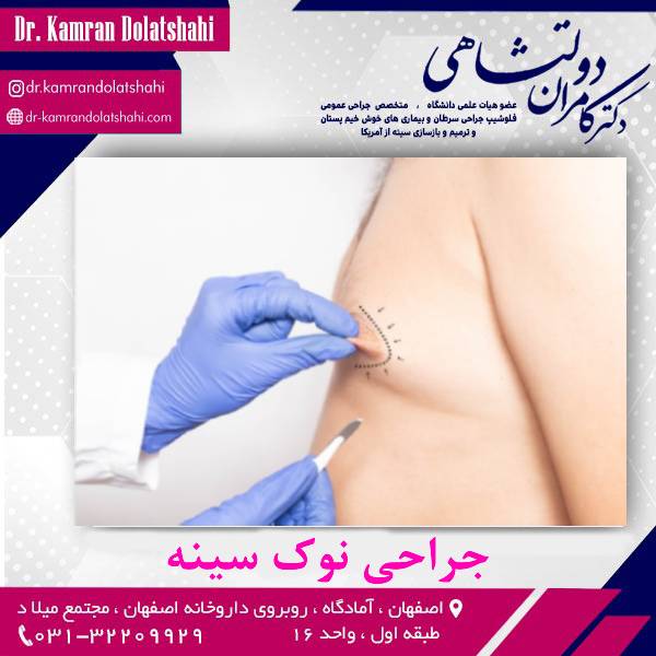جراحی نوک سینه