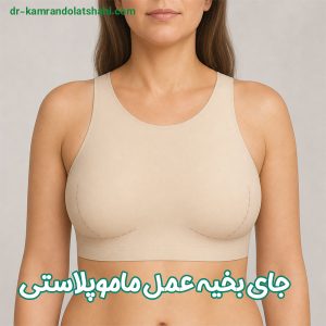 جای بخیه عمل ماموپلاستی - دکتر دولتشاهی