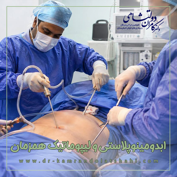 ابدومینوپلاستی و لیپوماتیک همزمان + دکتر کامران دولتشاهی