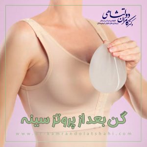 گن بعد از پروتز سینه + دکتر کامران دولتشاهی