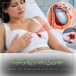 خونریزی بعد از پروتز سینه